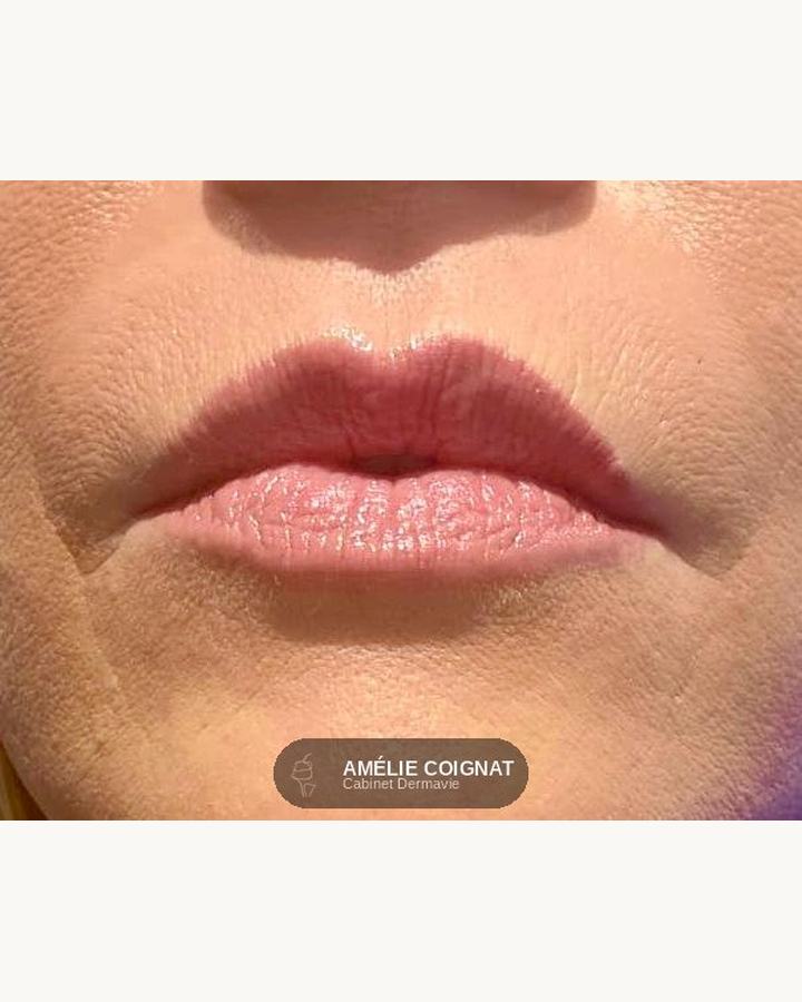 Nude jeune peau - Cabinet Dermavie Sainte-Maxime