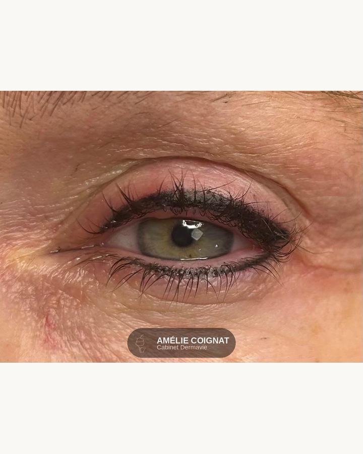 Lashliner eyeliner combine - Cabinet Dermavie Sainte-Maxime
